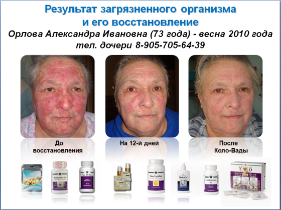 РЕЗУЛЬТАТ11