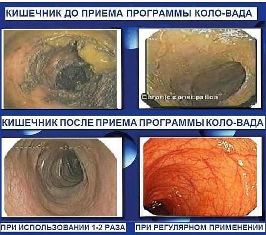 кишечник